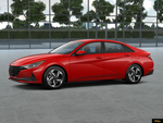 2023 Hyundai ELANTRA SEL Convenience